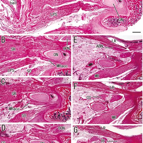 Horizontal Sections In A Fetus With A CRL Of 272 Mm Normal Fetus A