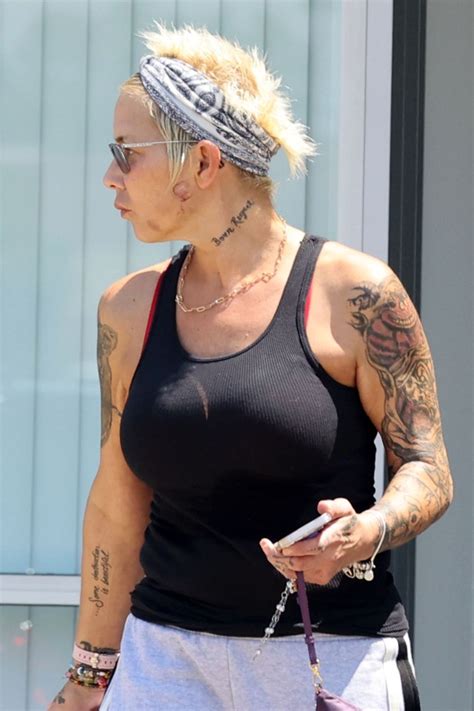 Eminem S Ex Wife Kim Mathers Is Seen With Injury On Her Face Photos