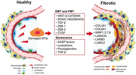 Cells Free Full Text Regeneration Or Repair The Role Of Alveolar