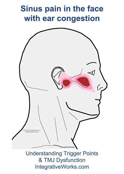 Ear And Jaw Pain On One Side Sinus Infection at Randi Mallon blog