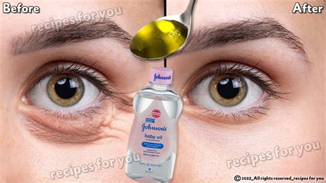 Under Eye Wrinkles Under Eye Puffiness Remove Dark Circles Dark Circles Under Eyes Vaseline