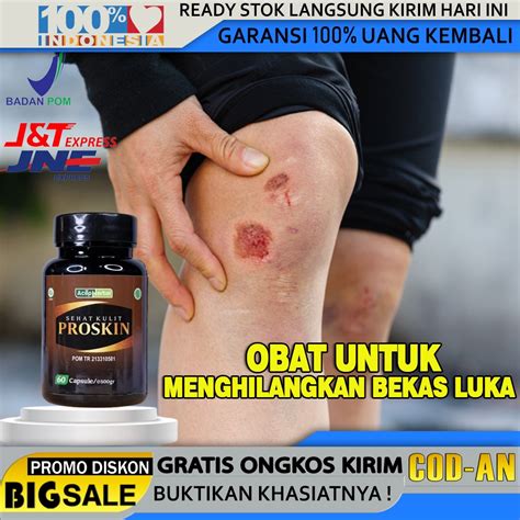 Jual OBAT Penghilang Bekas Luka Koreng Budug Santri Luka Hitam Luka