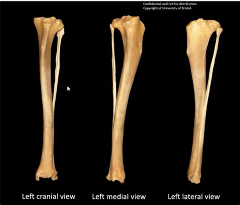 Tibia and fibula Diagram | Quizlet