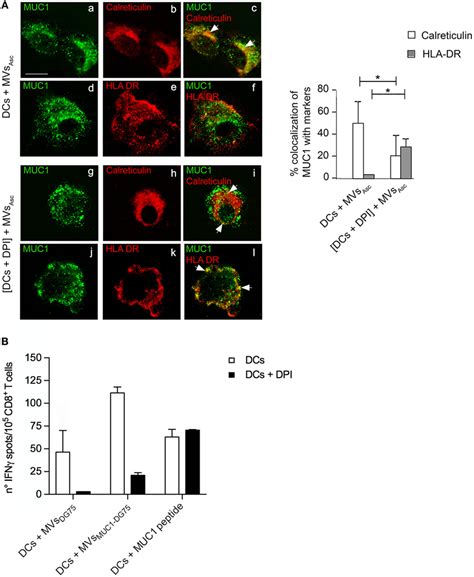 Frontiers Tumor Derived Microvesicles Modulate Antigen Cross