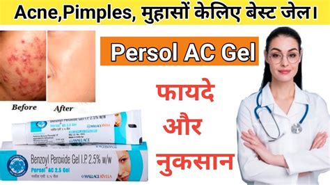 Persol Ac Gel Benzoyl Peroxide Gel Benzoyl Peroxide For