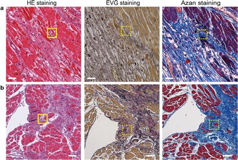 Identification Of Cardiac Progenitors That Survive In The Ischemic