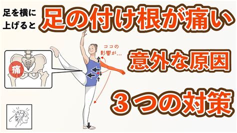 【足の付け根が痛い】足を横に上げると付け根が痛い意外な原因と3つの対策 Youtube