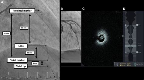 Frontiers Experience With A Novel High Frequency Optical Coherence