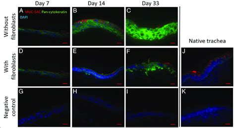 Immunohistochemical Staining Pan Cytokeratin And MUC5AC A C