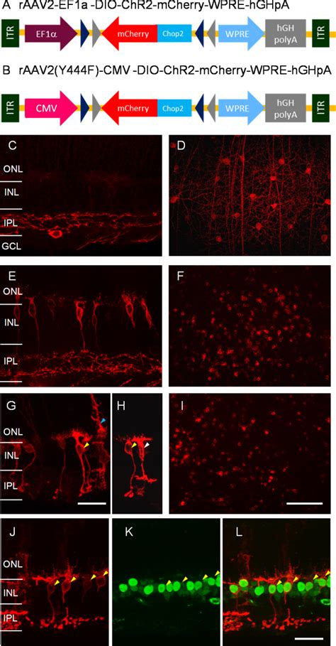 Cre Dependent Raav Mediated Transgene Delivery To Retinal Bipolar