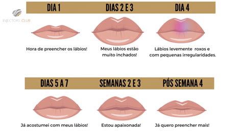 Prematuro Nosotros Mismos Promedio Preenchimento Labial M S Mermelada