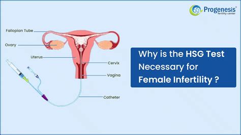 Why Is Hsg Test Necessary For Female Infertility