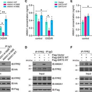 Sirt Regulates The Subcellular Localization Of Anxa A Primary