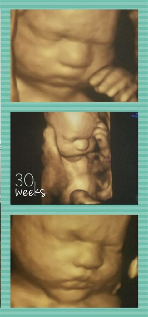 Gender reveal jacksonville ultrasound studio – Artofit