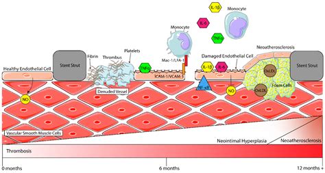 Biomolecules Free Full Text The Mechanisms Of Restenosis And