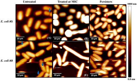 Escherichia Coli Morphology