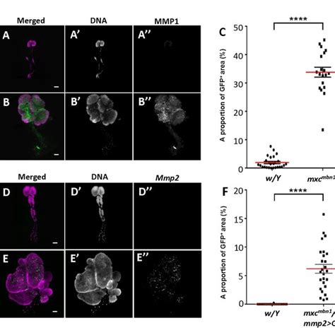 A Higher Expression Of Two Matrix Metalloproteinases Mmps In Lgs Of Download Scientific