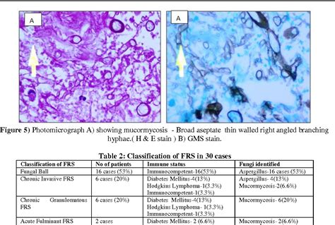 Figure From Role Of Histopathology In The Diagnosis Of Paranasal