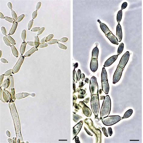 Pdf New Species Of Cladosporium Associated With Human And Animal