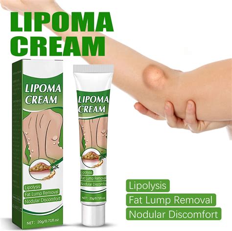 Buy KCRPM LipomaCure Soothing Ointment Lumpfree Lipoma Removal Cream