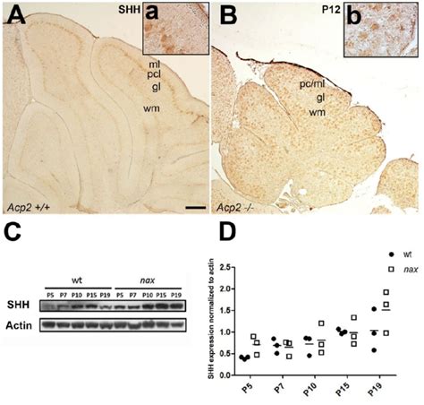 Shh Is Expressed To A Similar Extent By Cerebellar Pcs In Wt And Nax