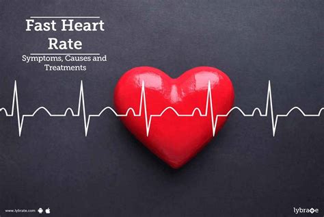 Fast Heart Rate Symptoms Causes And Treatments By Dr Rajiv Kumar Srivastava Lybrate