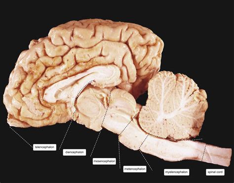 brain compartments anatomie en neurowetenschappen
