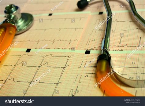 Healthy Concept Stethoscope Electrocardiogram Ecg Ekg Stock Photo