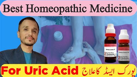 Uric Acid Best Homeopathic Medicine Urtica Urens Homeopathic Medicine