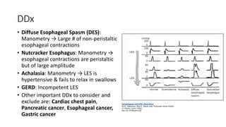 Hiatal hernias | PPT