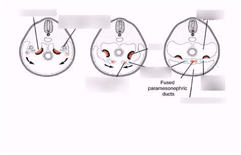 Paramesonephric Ducts Diagram | Quizlet