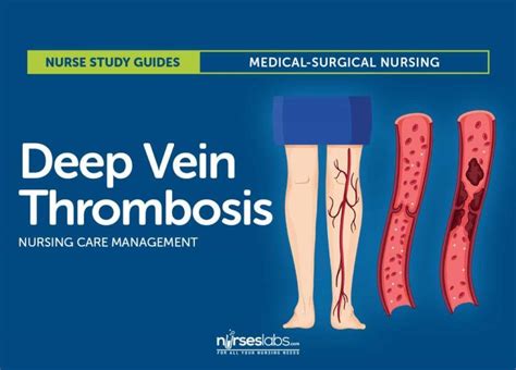 Superficial Venous Thrombosis