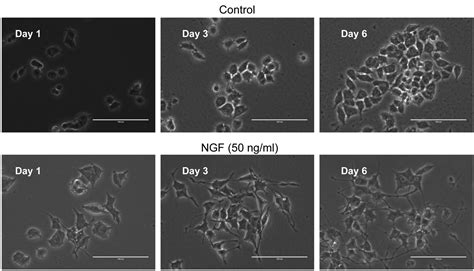 Change In Amino Acid Pools During Neuronal Differentiation Of Pc