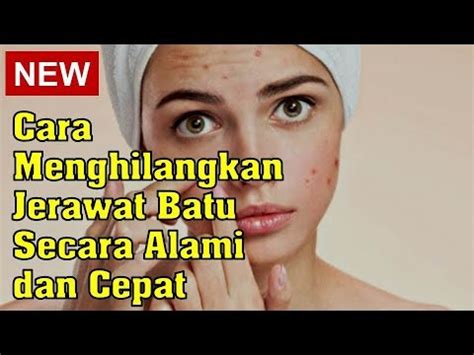 5 Cara Alami Mengobati Jerawat Batu Resep Sehat