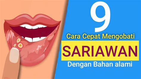 Cara Menyembuhkan Sariawan Dengan Cepat Youtube