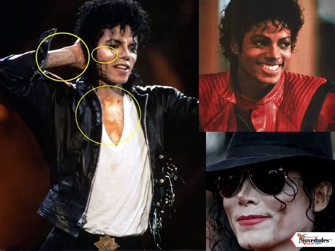 Cómo le hizo Michael Jackson para hacerse de piel blanca Novedades News