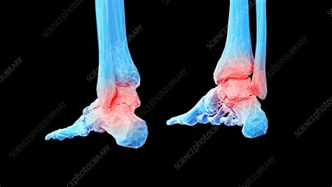 Feet bones, illustration - Stock Image - F038/5548 - Science Photo Library