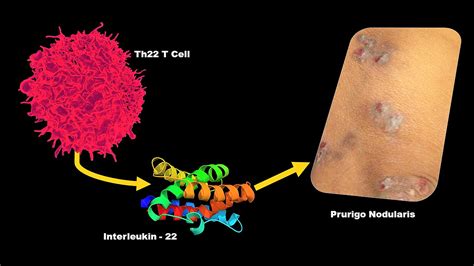 Research Story Tip: Johns Hopkins Medicine Team Discovers Novel ...