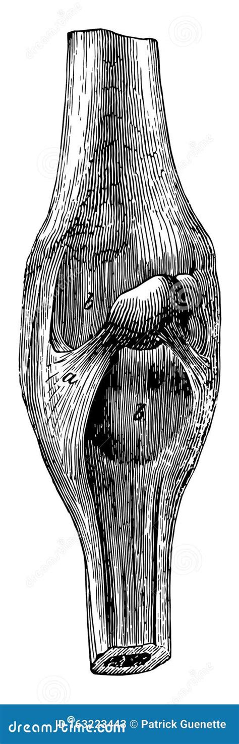 Superficial Ligaments Of The Carpus Vintage Illustration Cartoon