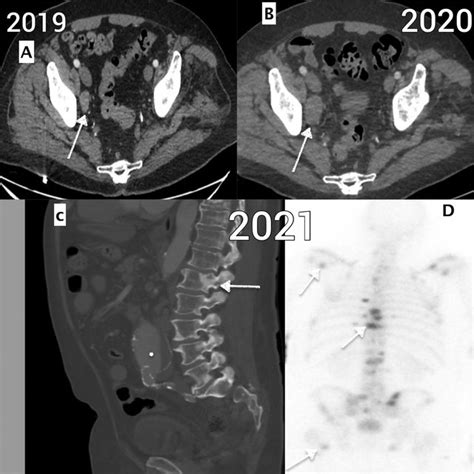 A Contrast Enhanced Ct Scan Axial Sections Done In 2019 It Shows Download Scientific