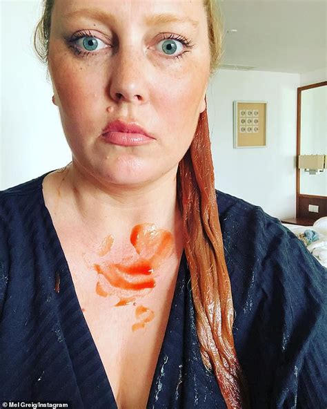 Mother Jessica Roberts Use Tomato Sauce On Daughters Head To Fix Green