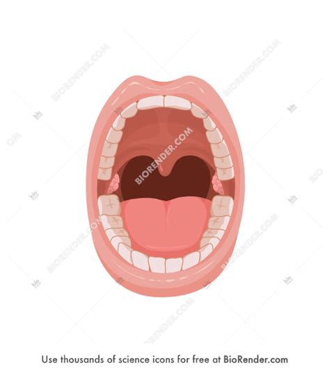 Open Mouth Diagram