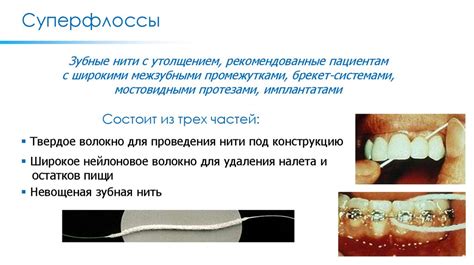 Средства гигиены полости рта (лекция 5) - презентация онлайн