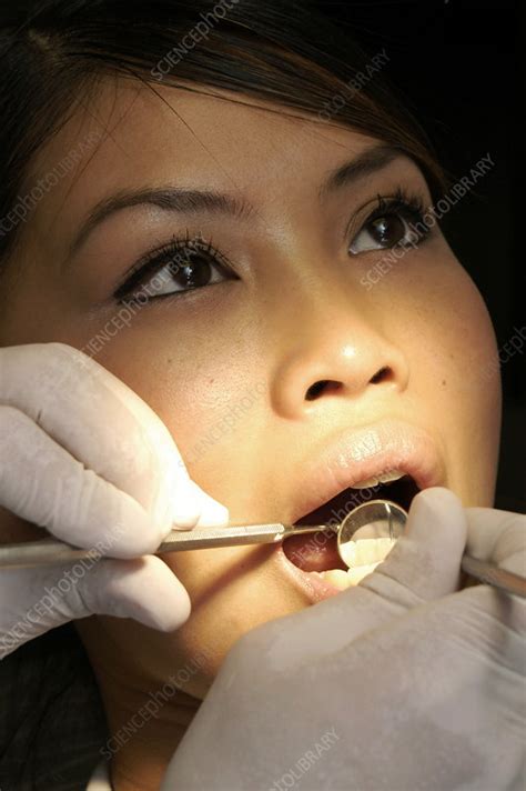 plaque removal stock image  science photo library