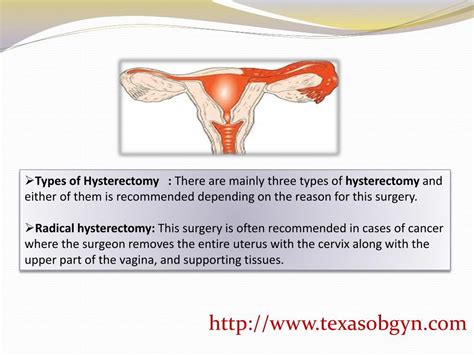 Ppt Reasons For Which A Woman Undergoes Hysterectomy Powerpoint