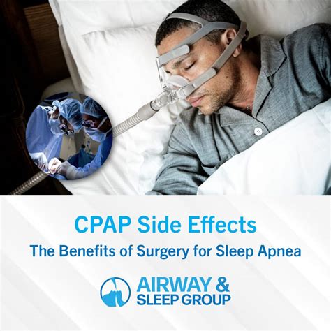 Comparing Sleep Apnea Treatments Airway Sleep Group