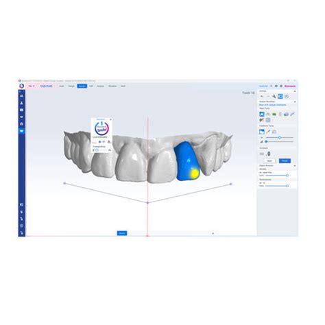 Software De Implantolog A Dental Romexis Planmeca M Dico