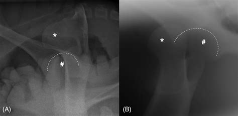 Preoperative Radiographs Of The Left Coxofemoral Joint A Right