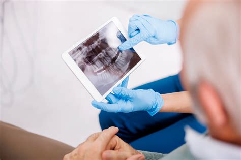 Dentist Showing Jaw Xray To Patient Stock Photo - Download Image Now - Adult, Adults Only, Care ...