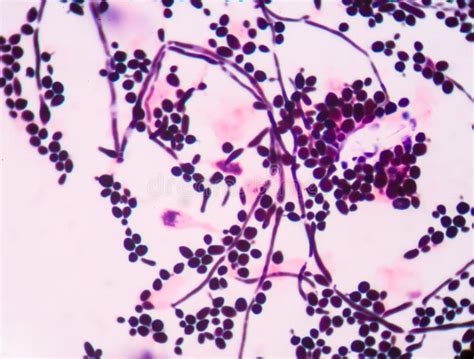 Budding Yeast Cells With Pseudohyphae Stock Photo Image Of Angina